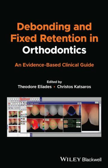 Debonding and Fixed Retention in Orthodontics