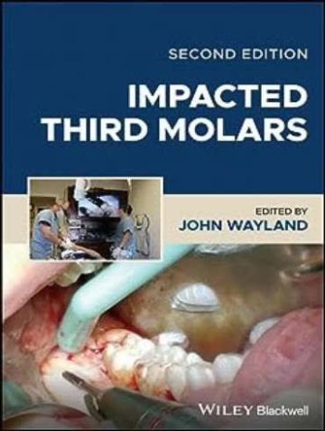 Impacted Third Molars 2nd Edition
