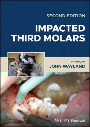 کتاب Impacted Third Molars – ایمپکتد ترد مولار