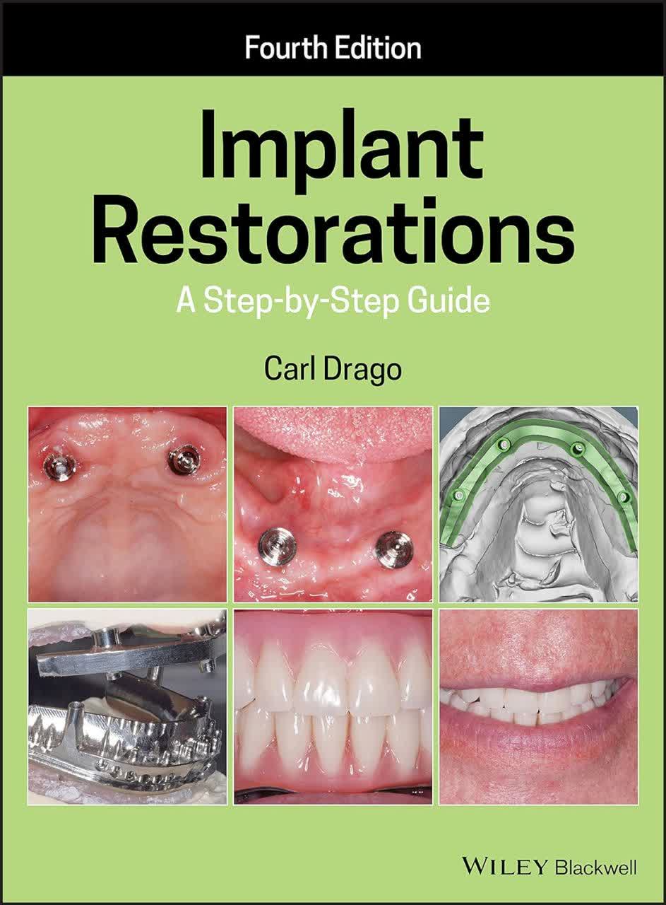 Implant Restorations: A Step-by-Step Guide – راهنمای گام به گام ترمیم ایمپلنت ویرایش چهارم